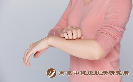 摄图网_501683946_女性身体不舒服手臂发痒（企业商用）
