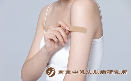 摄图网_501700725_胳膊受伤贴创可贴的女性（企业商用）