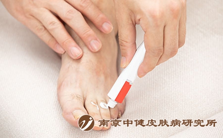 摄图网_501661624_脚部涂抹药膏（企业商用）