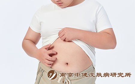 摄图网_501687663_青少年儿童皮肤瘙痒（企业商用）