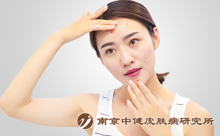 摄图网_500747236_长痘痘的女孩（企业商用）