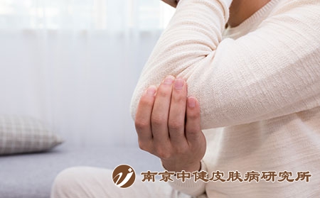 摄图网_500708291_生病的年轻人胳膊疼（企业商用）关节