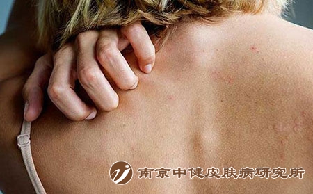 症状 (2)