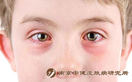 2 (273)眼睛