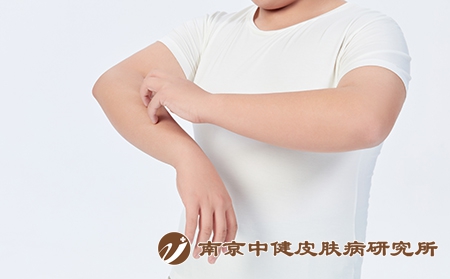 摄图网_501687661_青少年儿童皮肤瘙痒（企业商用）