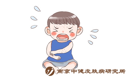 摄图网_401762381_儿童湿疹（企业商用）