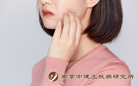 摄图网_501684066_女性被蚊虫叮咬抓脸颊牙疼（企业商用）