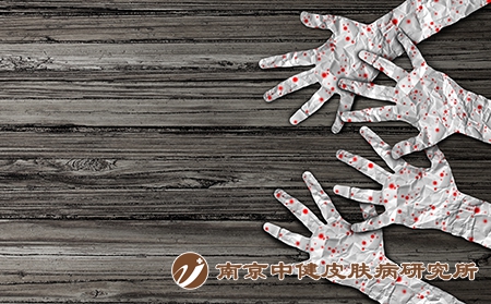 摄图网_300885372_麻疹公共危机疾病症状病疾病诊断为传染水痘皮疹接种问题的人群手纸图标三维插图风格（企业商用）