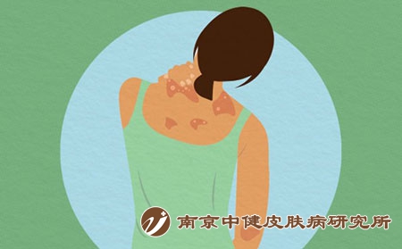 症状 (3) 症状 (3)