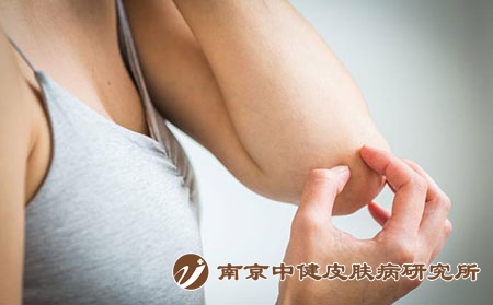 症状 症状