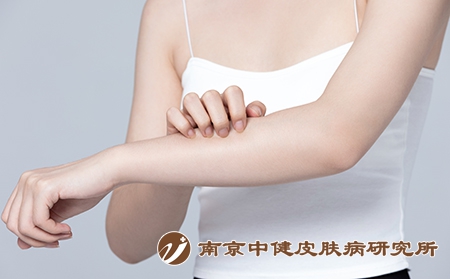 摄图网_501700721_皮肤过敏抓挠手臂的女性（企业商用）