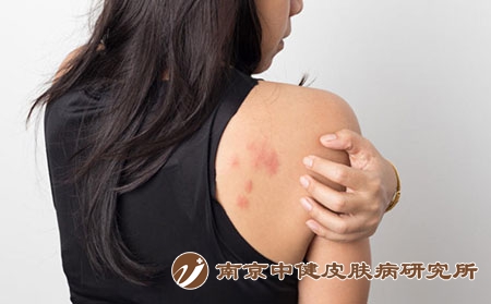 肩膀 症状