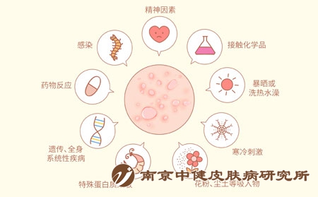摄图网_401804275_风疹荨麻疹发病原因科普医疗插画（企业商用）