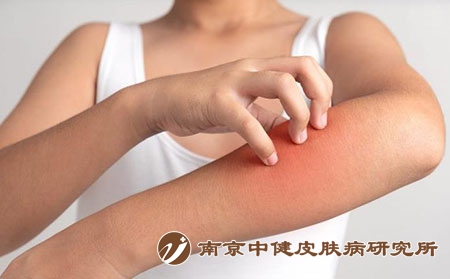 2 (262)瘙痒