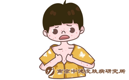 摄图网_401360863_过敏（企业商用）