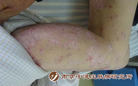 152